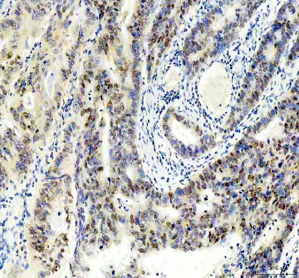 IHC analysis of PDX1/Ipf1 using anti-PDX1/Ipf1 antibody (M00491)