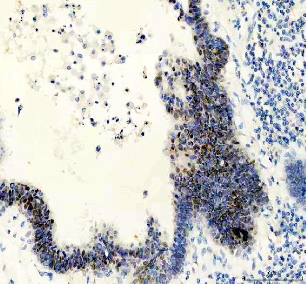 IHC analysis of PDX1/Ipf1 using anti-PDX1/Ipf1 antibody (M00491)