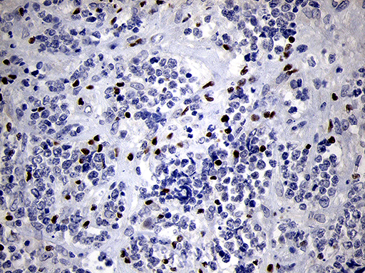 m00493 anti runx3 mouse monoclonal antibody clone id oti2g1 ihc testing 3