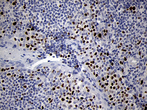 m00493 anti runx3 mouse monoclonal antibody clone id oti2g1 ihc testing 4