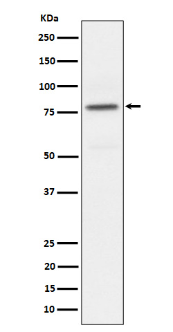 Western blot analysis of Phospho-PKC alpha (T497) expression in HeLa treated with Calyculin A cell lysate