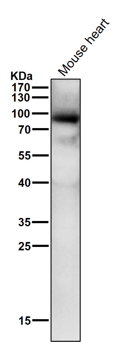 All lanes use the Antibody at 1:1K dilution for 1 hour at room temperature
