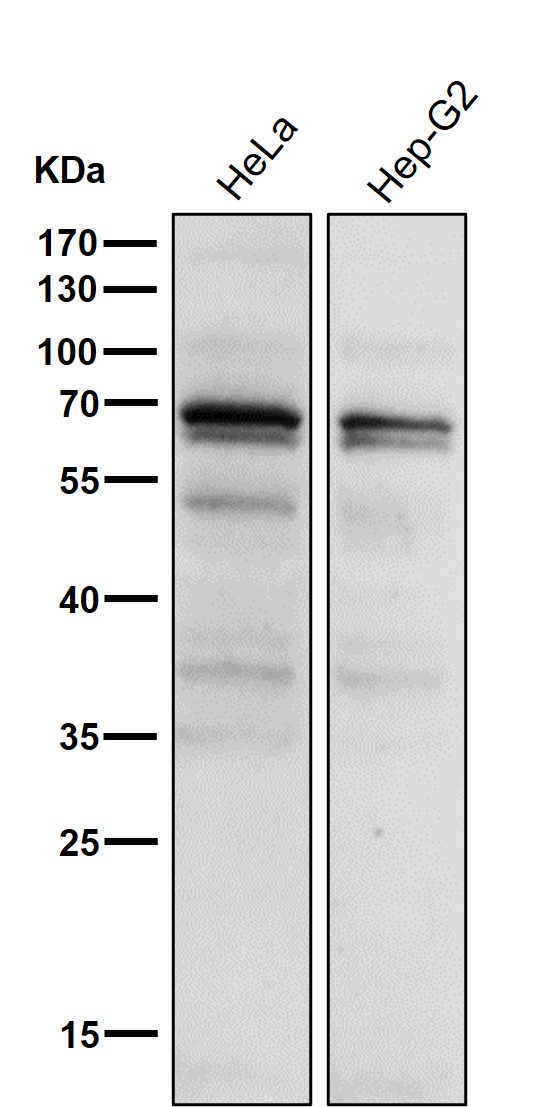 All lanes use the Antibody at 1:1K dilution for 1 hour at room temperature