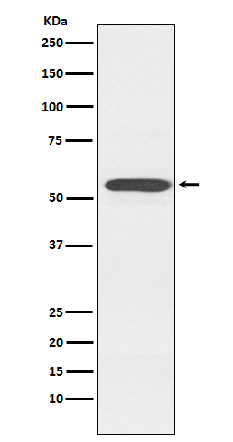 Western blot analysis of Cytochrome P450 2D6 expression in K562 cell lysate