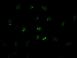 Immunofluorescent staining of HeLa cells using anti-GATA4 mouse monoclonal antibody (M00499-2)