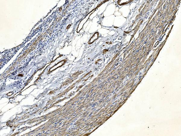 m00502 2 flna primary antibodies ihc testing 2_1
