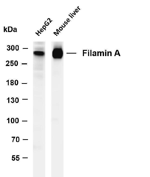 Various whole cell lysates were separated by 4-8% SDS-PAGE, and the membrane was blotted with anti-Filamin A antibody