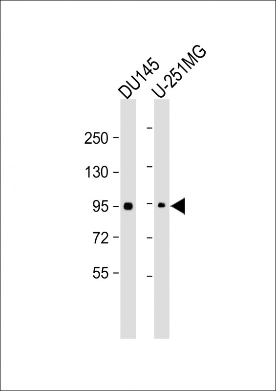 All lanes : Anti-NR3C1 at dilutionLane 1: DU145 whole cell lysateLane 2: U-251MG whole cell lysateLysates/proteins at 20 µg per lane