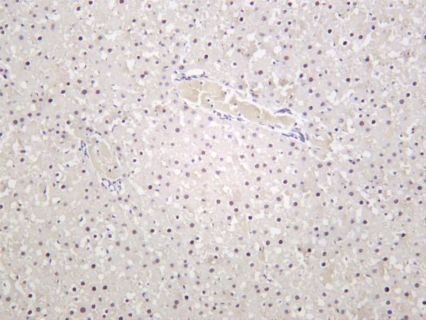 Rat liver was stained with anti-Glucocorticoid Receptor rabbit antibody