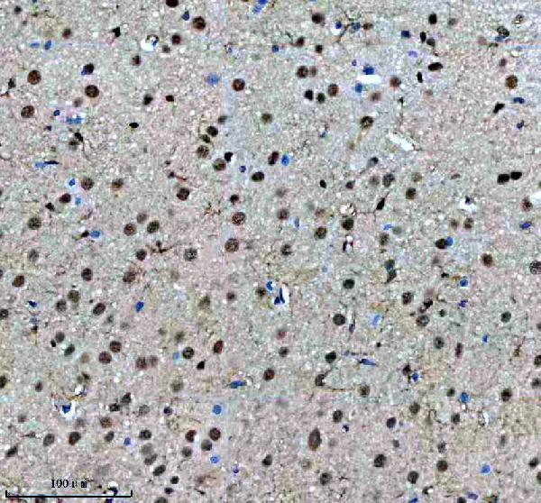 IHC analysis of SF3B1 using anti-SF3B1 antibody (M00507-1)