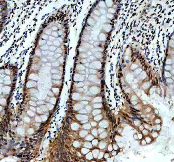 m00507 1 sf3b1 primary antibodies ihc testing 2