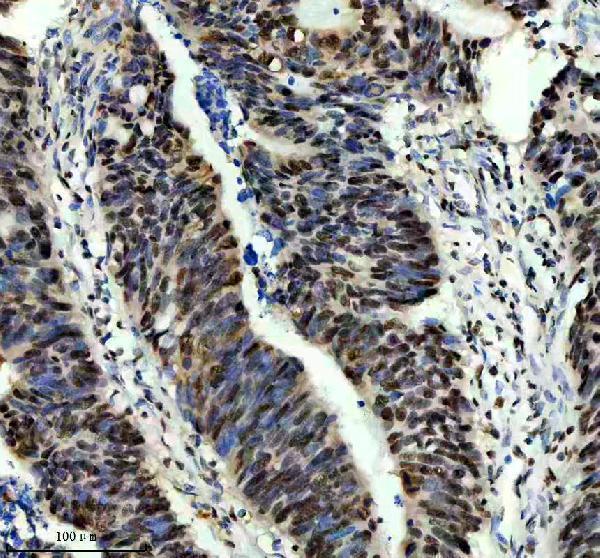 m00507 1 sf3b1 primary antibodies ihc testing 3