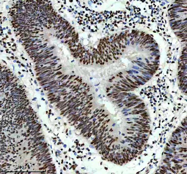 m00507 1 sf3b1 primary antibodies ihc testing 4