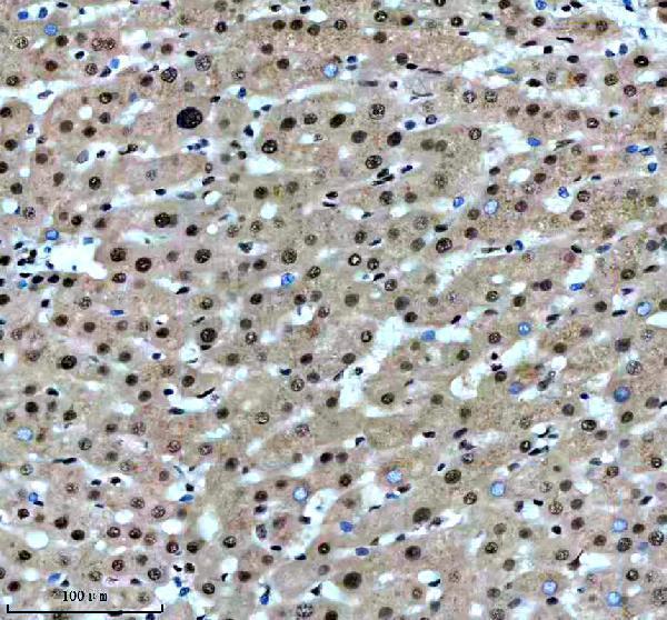m00507 1 sf3b1 primary antibodies ihc testing 5
