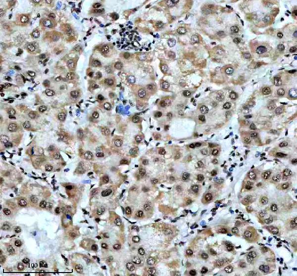 m00507 1 sf3b1 primary antibodies ihc testing 6