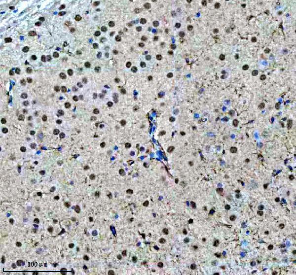m00507 1 sf3b1 primary antibodies ihc testing 8