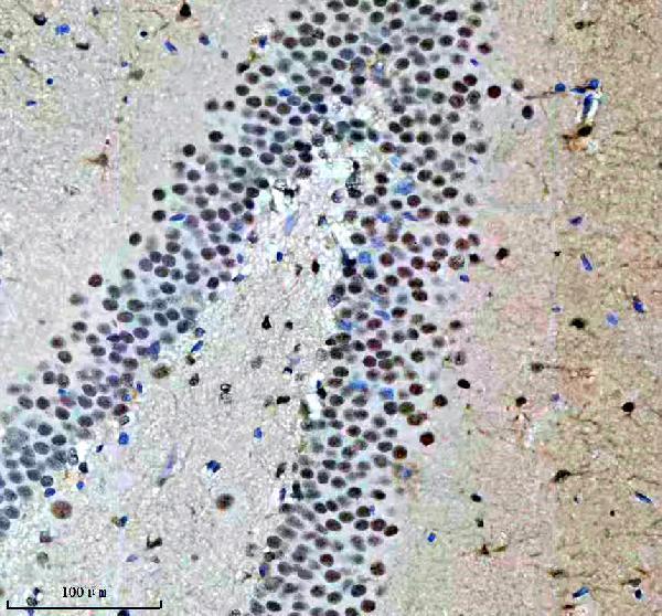 IHC analysis of SF3B1 using anti-SF3B1 antibody (M00507-1)