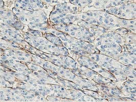 m00509 1 anti adiponectin adipoq mouse monoclonal antibody clone id oti1b2 ihc testing 5