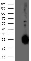 HEK293T cells were transfected with the pCMV6-ENTRY control (Left lane) or pCMV6-ENTRY ADIPOQ (Right lane) cDNA for 48 hrs and lysed