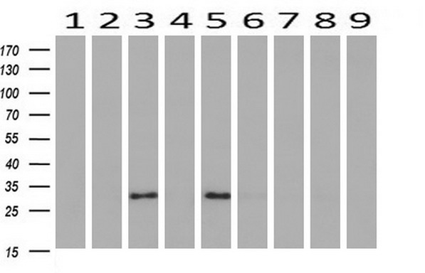Western blot analysis of extracts (10ug) from 9 Human tissue by using anti-ADIPOQ monoclonal antibody at 1:200 (1: Testis; 2: Omentum; 3: Uterus; 4: Breast; 5: Brain; 6: Liver; 7: Ovary; 8: Thyroid gland; 9: colon)