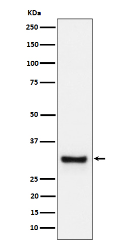 Western blot analysis of Adiponectin expression in human plasma cell lysate
