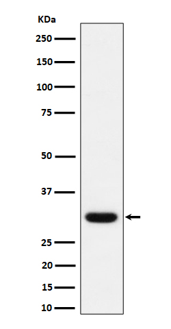 Western blot analysis of Adiponectin expression in human plasma lysate