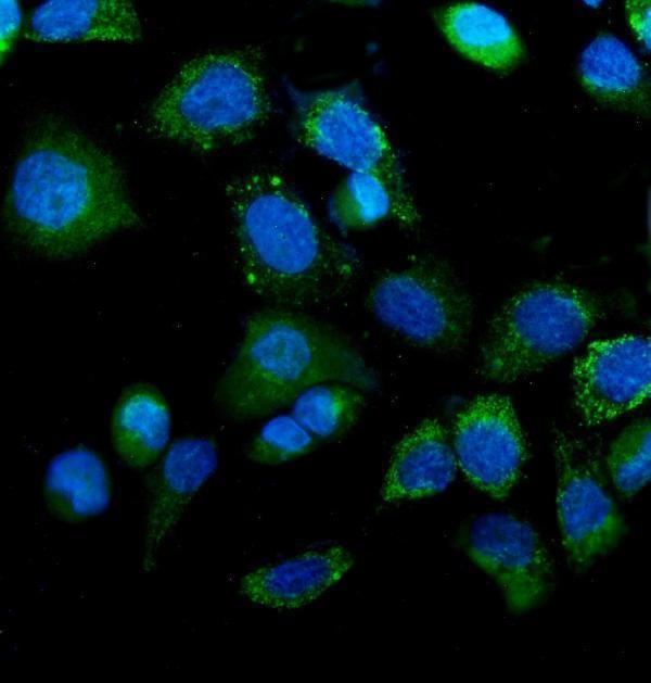 m00510 4 idh2 primary antibodies if testing 7