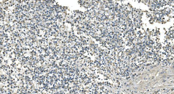 m00510 4 idh2 primary antibodies ihc testing 2