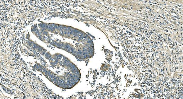 m00510 4 idh2 primary antibodies ihc testing 3