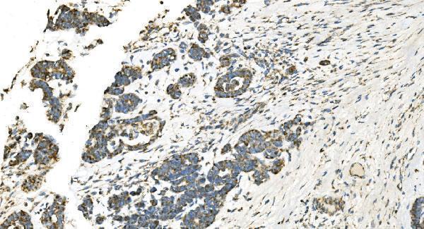 m00510 4 idh2 primary antibodies ihc testing 5