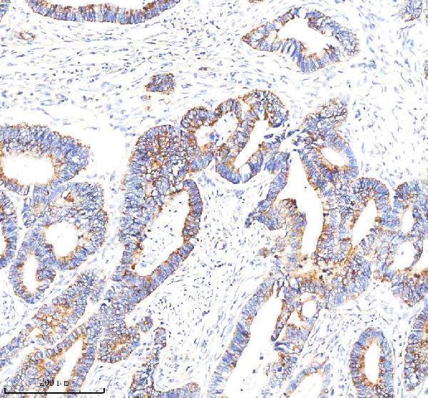 m00510 idh2 primary antibodies ihc testing 2
