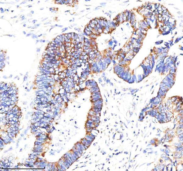 m00510 idh2 primary antibodies ihc testing 3