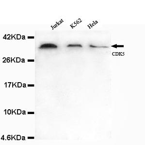 Western blot detection of CDK5 (N-terminus) antibody in Jurkat, K562&Hela lysates using CDK5 (N-terminus) antibody (1:1000 diluted) 