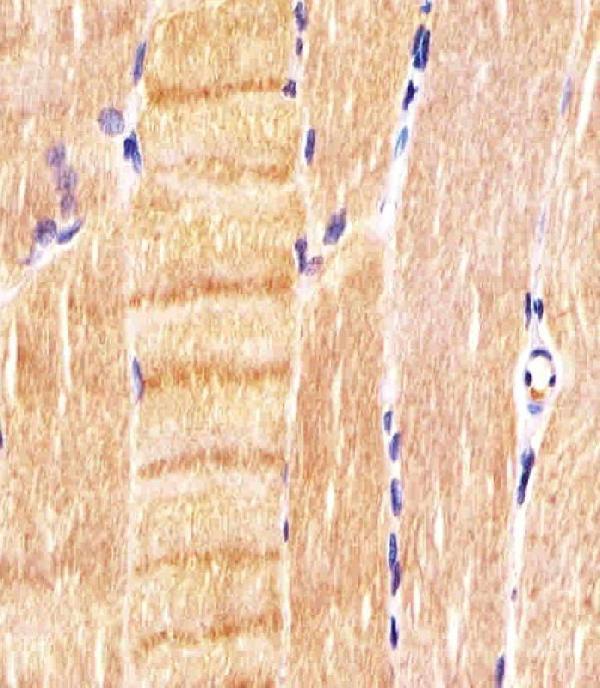 M00511-2 staining CDK5 in human skeletal muscle sections by Immunohistochemistry (IHC-P -paraformaldehyde-fixed, paraffin-embedded sections)