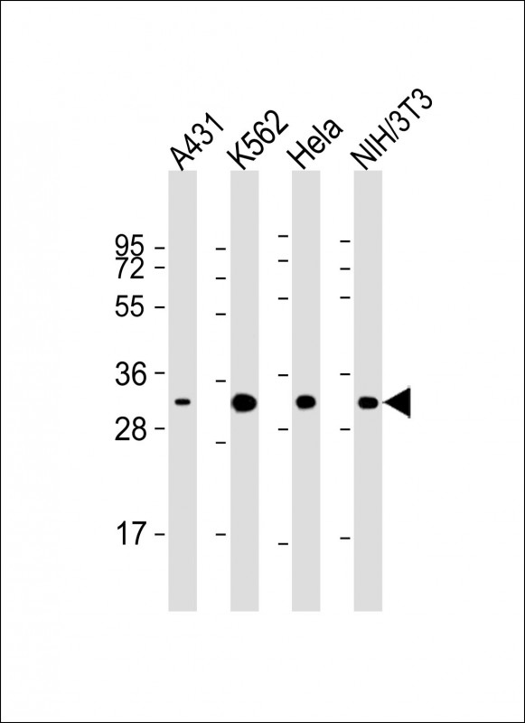 All lanes : Anti-CDK5 Antibody at 1:2000 dilutionLane 1: A431 whole cell lysateLane 2: K562 whole cell lysateLane 3: Hela whole cell lysateLane 4: NIH/3T3 whole cell lysateLysates/proteins at 20 µg per lane