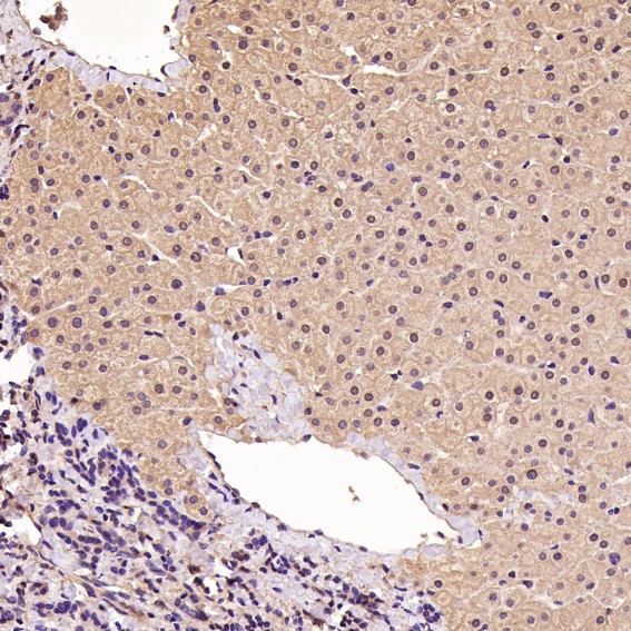 m00511 ihc11