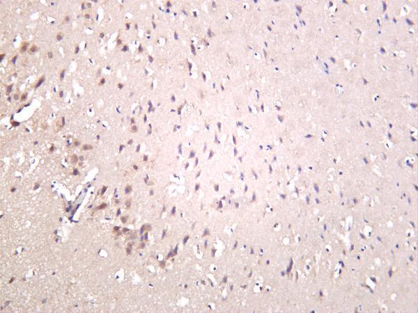 Rat brain was stained with anti-Keap1 rabbit antibody