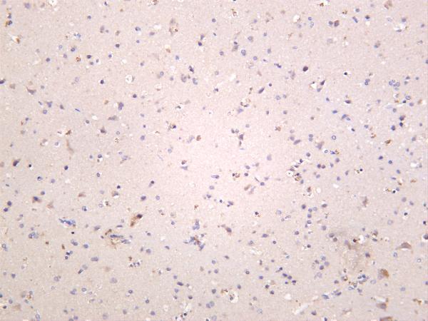 Human brain was stained with anti-Keap1 rabbit antibody