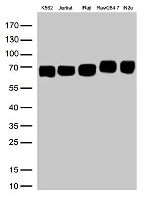Western blot analysis of extracts (50ug per lane)
from 5 cell lines lysates by using anti-TMEM173
monoclonal antibody(M00514, 1:500)