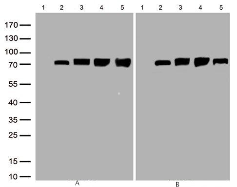 Figure A, Western blot analysis of overexpressed
lysates(25ug per lane) from HEK293T cells
transfected with empty plasmid, lane
1) , human KEAP1 plasmid, lane 2),
mouse KEAP1 plasmid transcript variant 2, lane 3), mouse KEAP1 plasmid
transcript variant 4, lane 4), rat
KEAP1 plasmid, lane 5) using antiKEAP1 antibody M00514 (1:500)