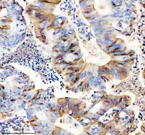 IHC analysis of CYP1B1 using anti-CYP1B1 antibody (M00515)