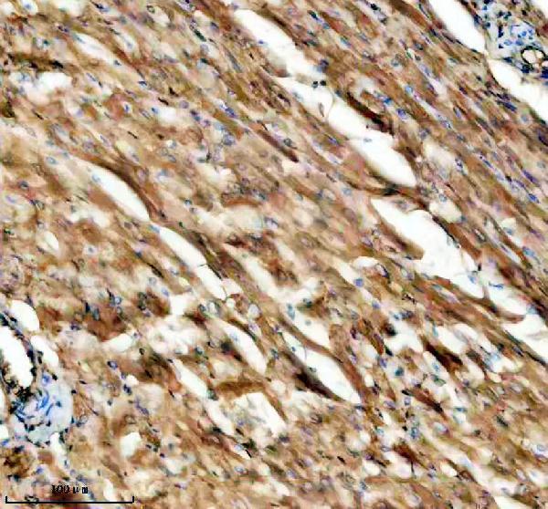 IHC analysis of CYP1B1 using anti-CYP1B1 antibody (M00515)