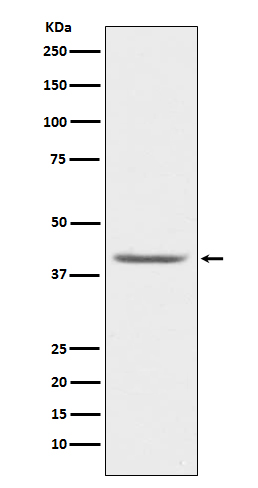 Western blot analysis of PON1 expression in human plasma lysate