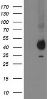 HEK293T cells were transfected with the pCMV6-ENTRY control (Left lane) or pCMV6-ENTRY PON1 (Right lane) cDNA for 48 hrs and lysed