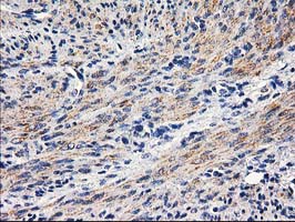 Immunohistochemical staining of paraffin-embedded Human endometrium tissue within the normal limits using anti-PON1 mouse monoclonal antibody