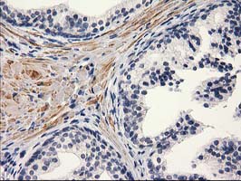 Immunohistochemical staining of paraffin-embedded Human prostate tissue within the normal limits using anti-PON1 mouse monoclonal antibody
