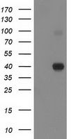 HEK293T cells were transfected with the pCMV6-ENTRY control (Left lane) or pCMV6-ENTRY PON1 (Right lane) cDNA for 48 hrs and lysed