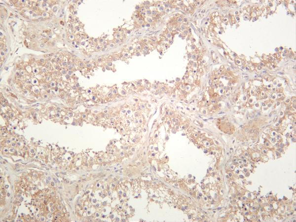 Human testis was stained with anti-Notch2 rabbit antibody