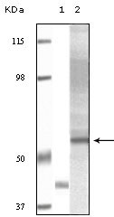 Western Blot analysis using Akt3 Monoclonal Antibody against truncated Akt3 recombinant protein (1) and human ovary carcinoma tissue lysate (2)