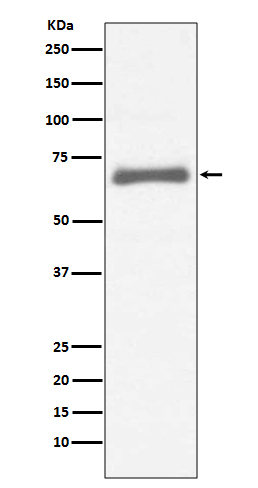 Western blot analysis of AFP expression in HepG2 cell lysate